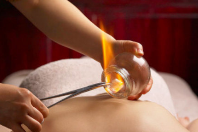 Chinese Fire Cupping