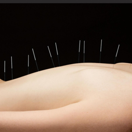 back and cautionary needling